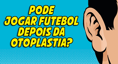 Pode jogar futebol depois da otoplastia? otoplastia-jogar-futebol